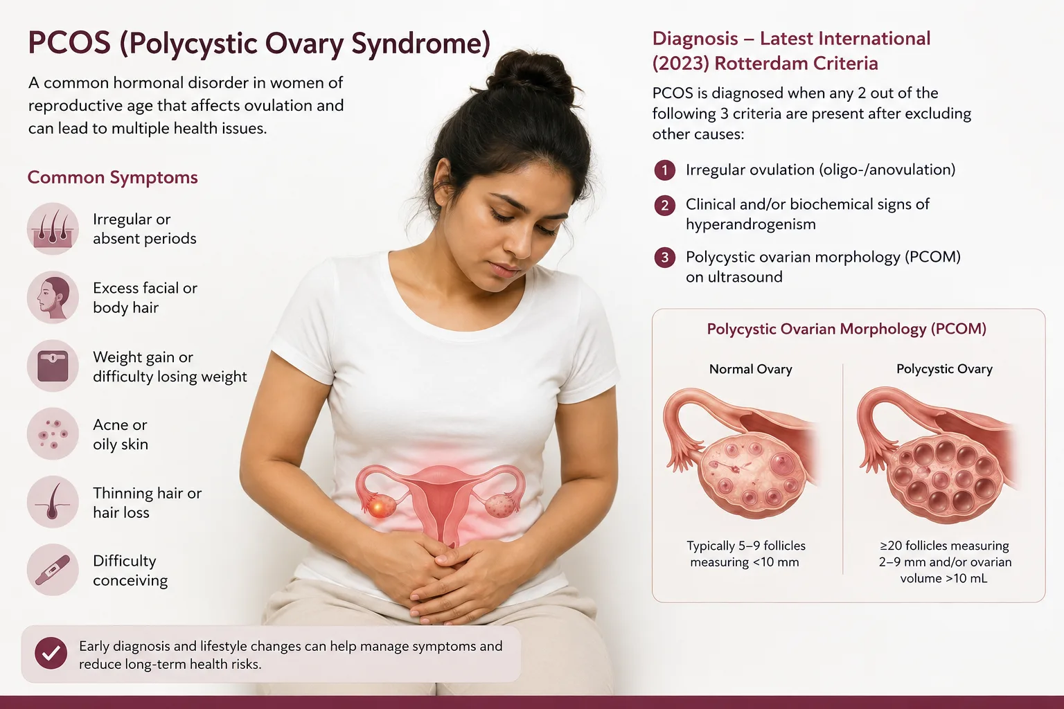 PCOS overview infographic. Common symptoms: irregular or absent periods; excess facial or body hair; weight gain or difficulty losing weight; acne or oily skin; thinning hair or hair loss; difficulty conceiving. Diagnosis under the 2023 Rotterdam criteria: PCOS is diagnosed when any two of three are present after excluding other causes - irregular ovulation, clinical or biochemical signs of hyperandrogenism, and polycystic ovarian morphology on ultrasound. A comparison diagram shows a normal ovary, typically 5 to 9 follicles measuring under 10 mm, beside a polycystic ovary, 20 or more follicles measuring 2 to 9 mm and/or an ovarian volume above 10 mL. Early diagnosis and lifestyle changes can help manage symptoms and reduce long-term health risks.